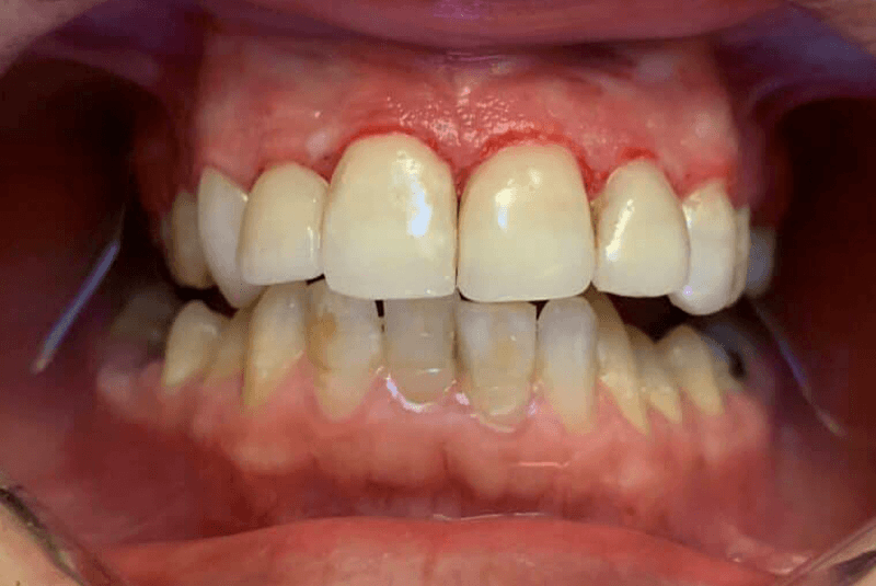 after dental procedure image