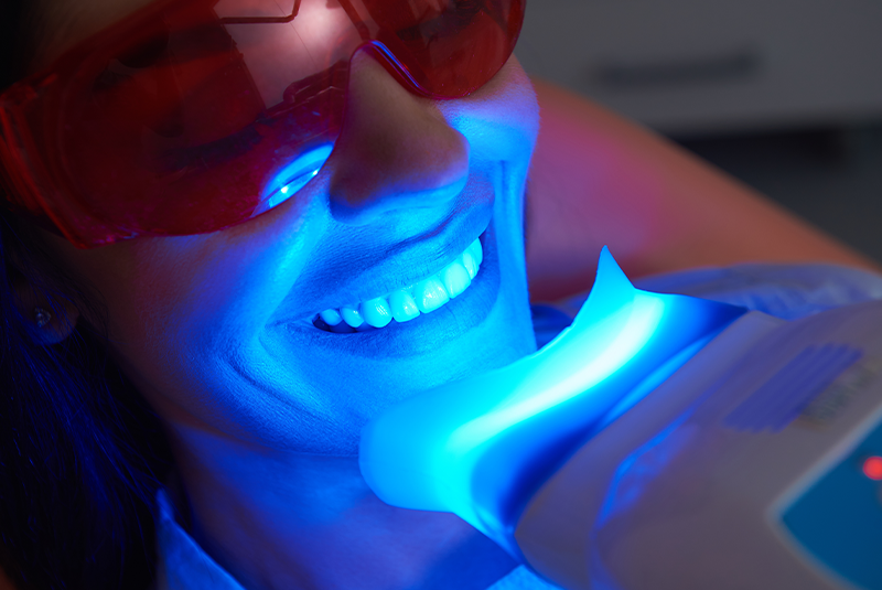 teeth whitening photo
