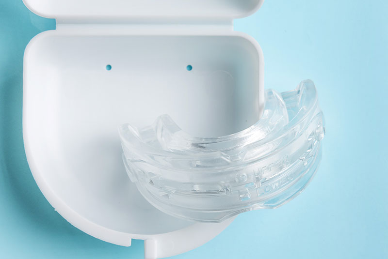 mouthguard for dental issues